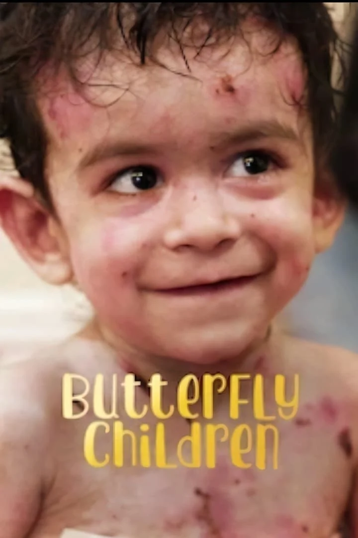 Những đứa trẻ da cánh bướm Butterfly Children